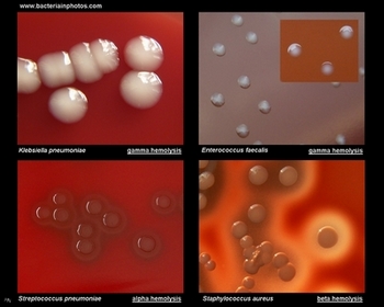 alpha, beta and gamma hemolysis